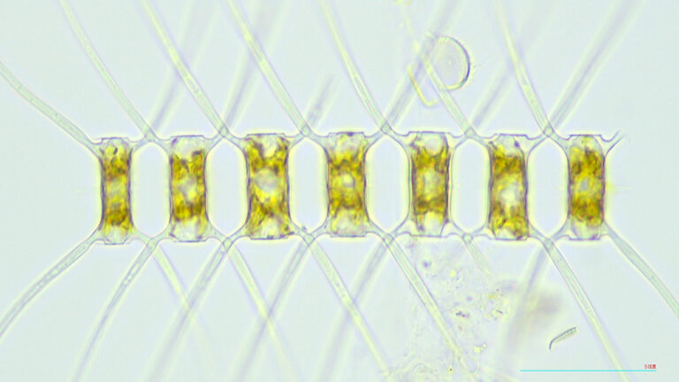 The diatom Chaetoceros atlanticus, a type of marine phytoplankton responsible for primary production in the ocean through photosynthesis. (Photo courtesy of Kohei Matsuno).