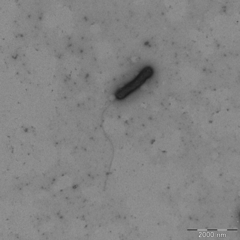 Thermophilic bacteria photographed by transmission electron microscopy (2020, Courtesy of Sayaka Mino).