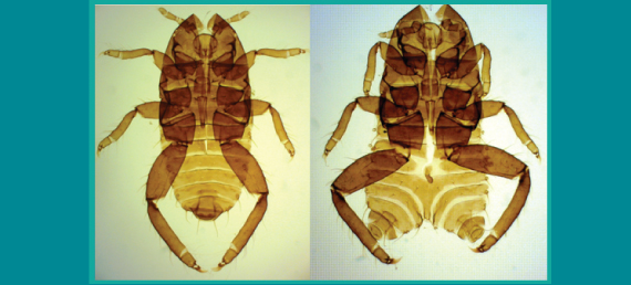 Fig. 1A  Normal (left) and malformed (right) first instars of Tetraneura sorini.
