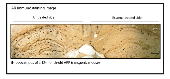 Clearance of Aß from the brain by the administration of exosomes. (pic 2) 