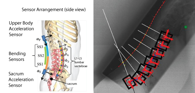 Sensor Configuration and Estimated Results for Lumbosacral Spine Alignment: Using a group of sensors arranged on the back can non-invasively estimate the lumbar shape, similarly to what an X-ray image does. (left: sensor configuration, right: X-ray image results (red) and estimated results (black))