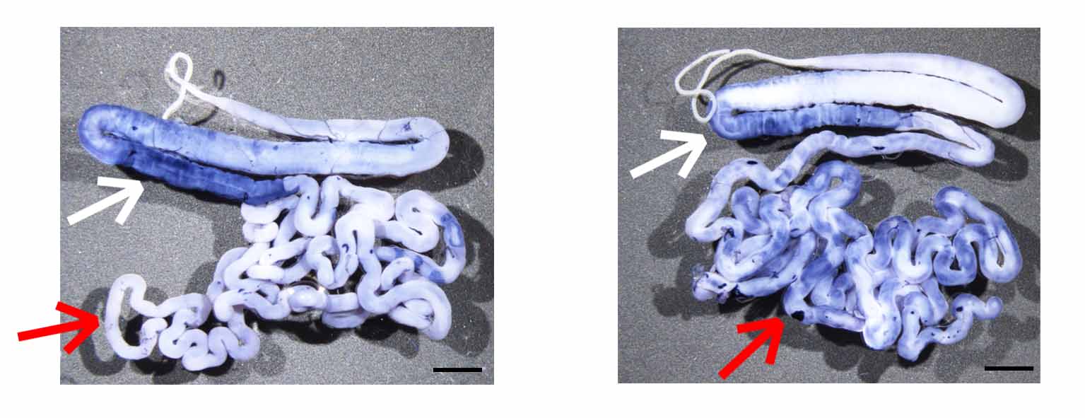 <strong>(left)</strong> Normal silk gland, <strong>(right)</strong> Silk gland in which Antennapedia is strongly expressed <br />　<br />The white arrow is the middle silk gland, and the red arrow is the posterior silk gland. Blue shows the strength of genes that are normally induced in the middle silk gland, and the darker the blue, the more strongly are the genes induced.<br /> In the silk gland on the right, as the result of making Antennapedia act strongly, genes that are normally induced only in the middle silk gland are now even being induced in the posterior silk gland. <br />The lengths of the black lines at the bottom right of the photographs are each 0.3 cm.