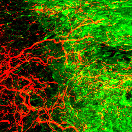 <b>CST axons entering into the graft (Green, graft; Red, CST axon)</b>  [copyright: Ken KADOYA]