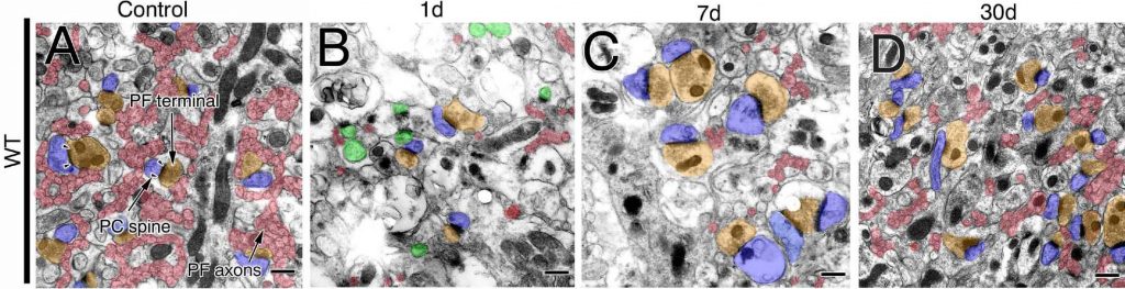 Sections of the cerebellums after the incision. The number of parallel fibres (PF) was largely reduced on day 1. Parallel fibres were thickened and their terminals were enlarged on day 7. The number of parallel fibres and synapses was recovered on day 30. (Ichikawa R. et. al., The Journal of Neuroscience, April 27, 2016)