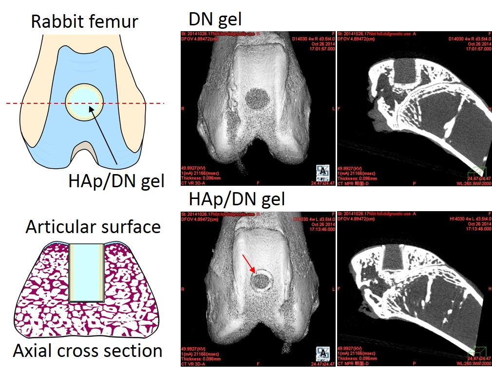 The DN gel and HAp/DN gel implanted in rabbit femurs. 