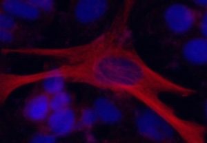 Inducing neuronal differentiation using CRISPR/Cas9-MMEJ system. Seven days after OLIG2 was switched on, cultured human stem cells started expressing neuronal marker gene (red).