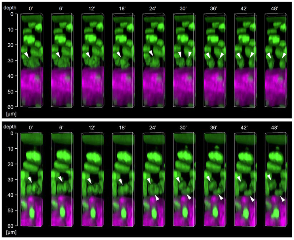 Parallel division and oblique division of cells