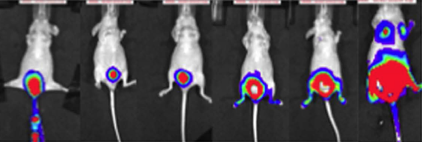 Tumor growth in the xenograft bladder cancer model