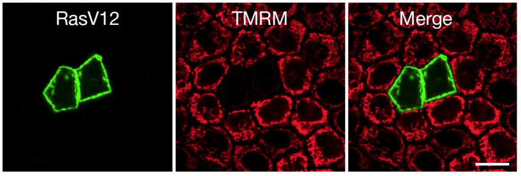 Transformed cells 