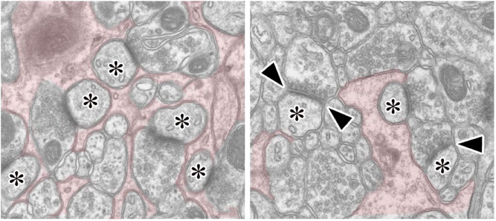 Connections between Purkinje cells 