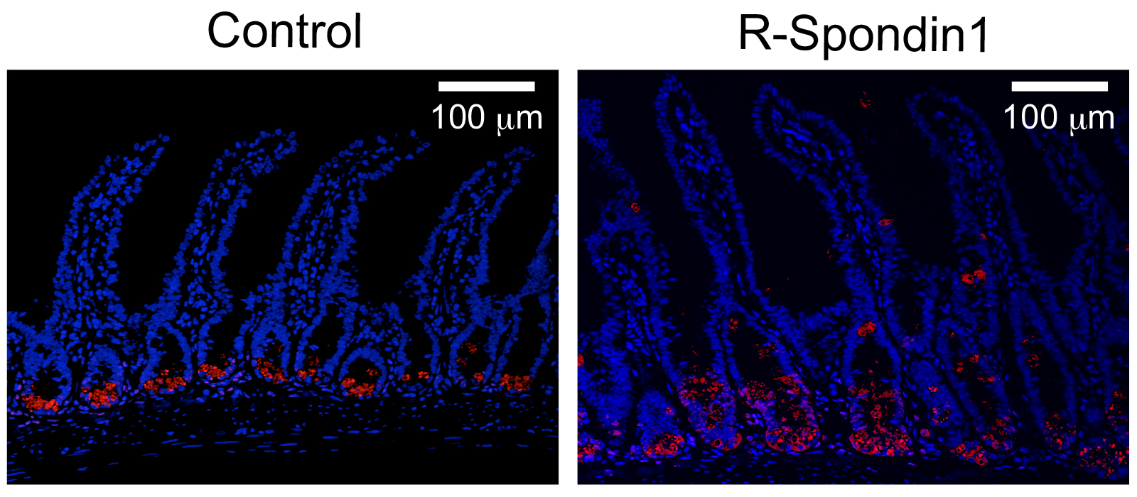 The administration of R -Spondin1 resulted in the increased secretion of α-defensin (right) compared to the control experiment (left).