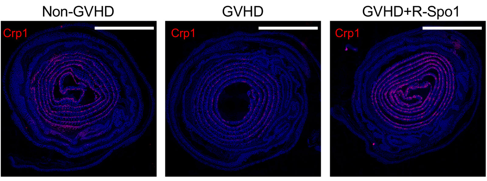 R-Spondin1 protects Paneth cells against GVHD and ameliorates intestinal dysbiosis. The images show rolled intestines after hematopoietic stem cell transplantation with (right) or without (middle) R-Spondin1. (Hayase E. et al., Journal of Experimental Medicine, October 24, 2017)