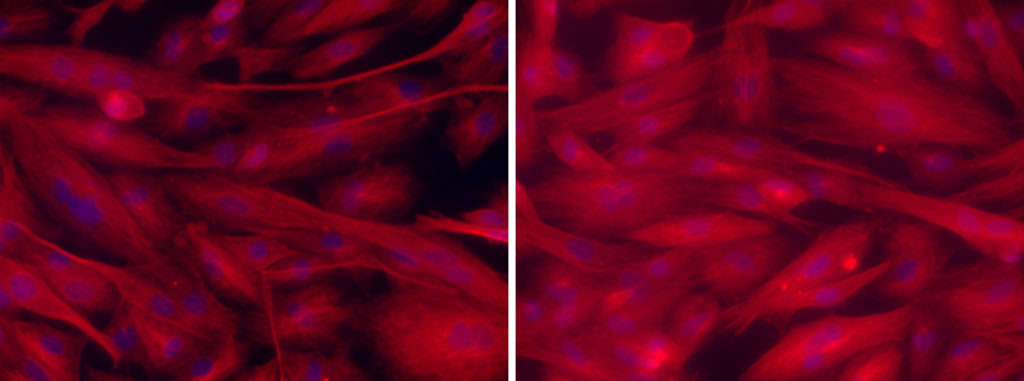 Cultured cells showing hypertrophy