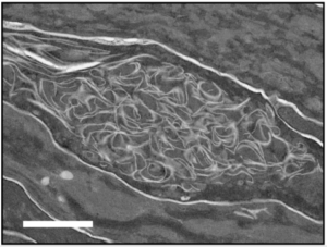 Abnormal membrane structure observed in the outermost skin layer of a mouse lacking FATP4. Scale: 1µn. (Yamamoto H., et al., Proceedings of the National Academic of Sciences of the United States of America, January 23, 2020.)