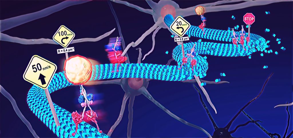 Cellular train track deformities shed light on neurological ...