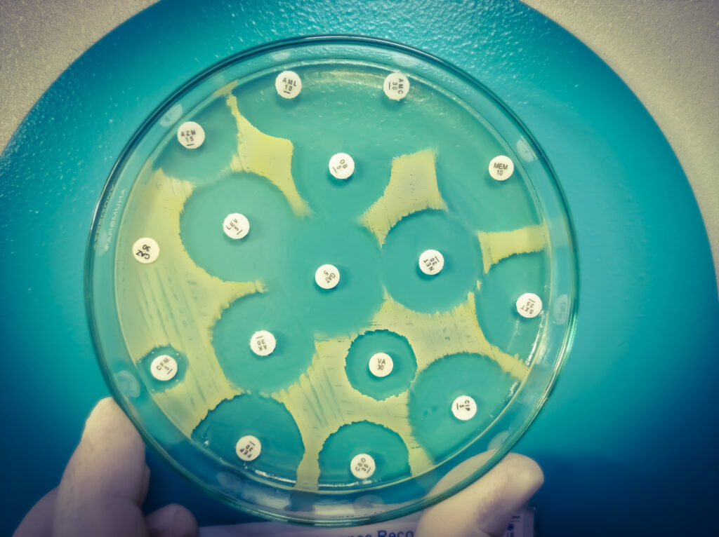 A stock photo of a disk diffusion assay to test the effectiveness of antibiotics. Photo by Babul Hosen, from Shutterstock.