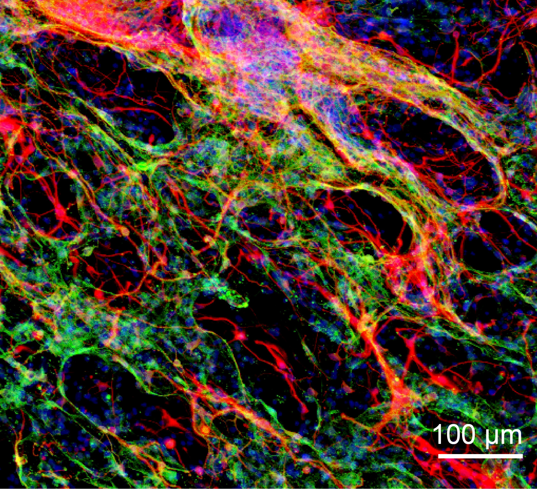 Immunofluorescence image of neurons and astrocyte cells in the engineered hydrogel (Satoshi Tanikawa, et al. Scientific Reports. February 14, 2023).
