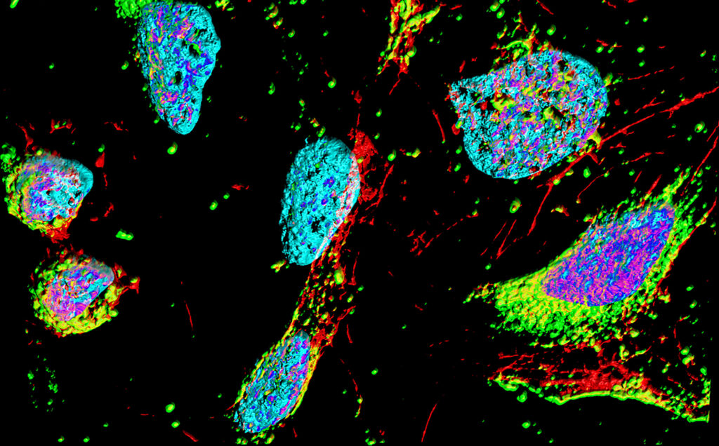 A light micrograph of fluroescent-labelled HeLa cells in culture. Photo by Heiti Paves, Shutterstock.