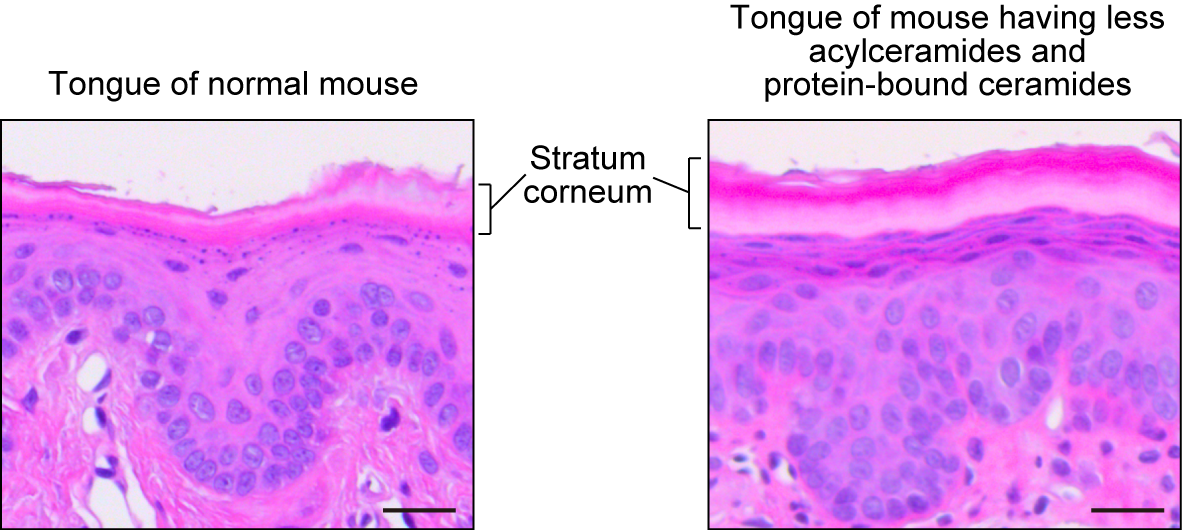 Engrosamiento del estrato córneo en la parte inferior de la lengua en ratones con niveles reducidos de acilceramidas y ceramidas unidas a proteínas, que recuerda a la deficiencia de la barrera cutánea.  Escala, 25 μm.  (Takayuki Sassa, Akio Kihara. Cell Reports, 12 de abril de 2023).