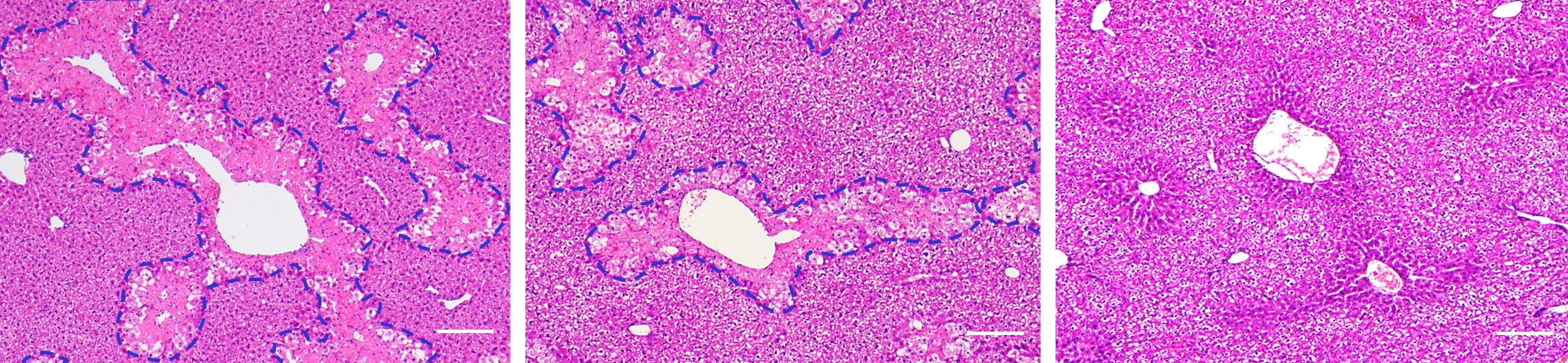 Damage to the liver induced by acetaminophen (dotted blue outlines) is almost completely mitigated by CoQ10-MITO-Porter (right), compared to the effect of phosphate buffered saline (left) and direct administration of CoQ10(center). (Mitsue Hibino, et al. Scientific Reports. May 10, 2023).