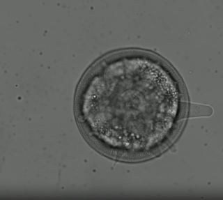 How Does a Shelled Amoeba Move?
