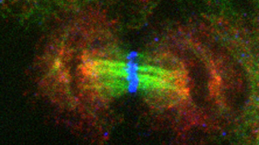 Chromosomal DNA (blue) aligned at the center of a dividing cell.